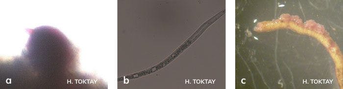Turunçgil nematodu dişi bireyi, larvası ve yumurta paketleri